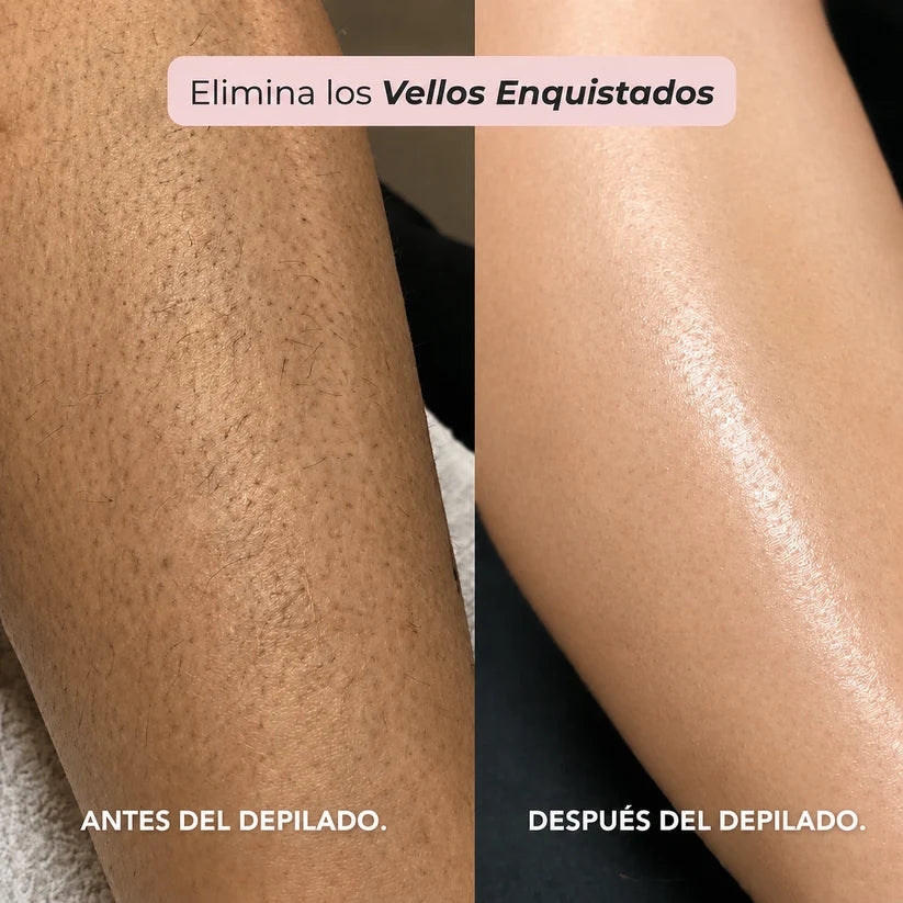 Depiladora Dermave® - Olvidate del dolor al depilar