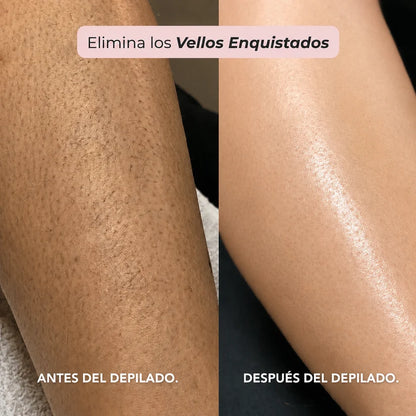 Depiladora Dermave® - Olvidate del dolor al depilar